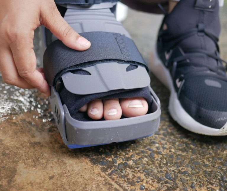 car accident foot injury
